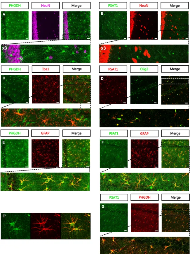 Figure III.3 – Co-Marquages fluorescents PHGDH et PSAT1 dans l’hippocampe de souris. 