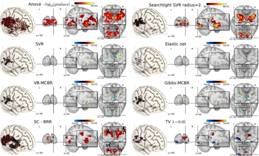 Fig. 1. Maps obtained for different methods studied, in the inter-subject analysis. First row: the two brain mapping approaches Anova (left) and Searchlight (right) found similar regions