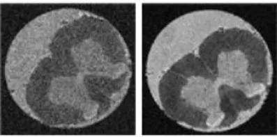 Fig.  2  –  Ex  vivo  rat  spinal  cord  image. 