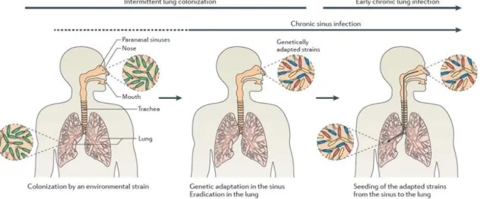 Figure  3,  shows  the  initial  process  of  colonization  of  the airways  in  CF patients  and  theàesta lish e tàofàea l à h o i àlu gài fe tio .àB iefl ,àpatie t sàai a s,à othàlu gsàa dà sinuses,  are  colonized  by  environmental  P