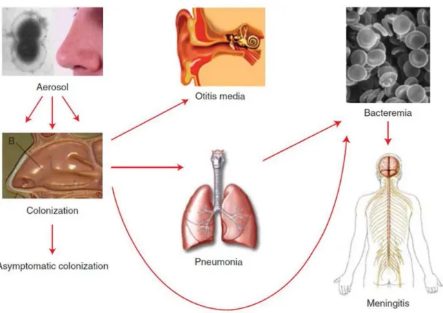 Figure 8: Pneumococcus pathogenesis (Henriques-Normark &amp; Tuomanen, 2013). 