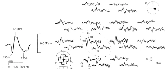 Figure 1.1.4 : Réponses évoquées mesurées avec des SQUIDs. A gauche, réponse à un stimulus auditif de 50 ms, extrait de  [16]