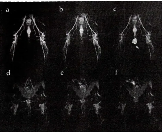 Figure 4 : Images par résonance magnétique d’arrières trains de lapin après injection soit de MS-325  (0,025 mmol.kg -1  ; a-c), soit de GdDTPA (0,1 mmol.kg -1  ; d-f)