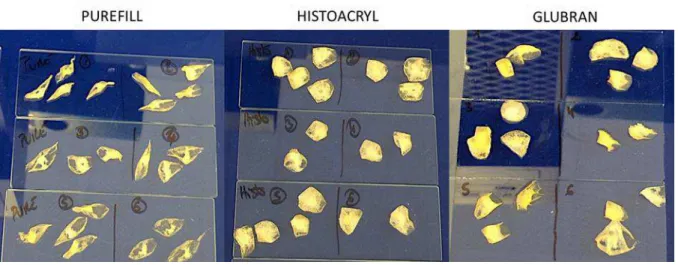 Figure 35 : Aspect macroscopique des produits de polymérisation colle-lipiodol, au ratio 1:1