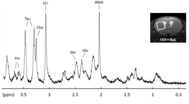 Figure II.6 :  E e ple d’u  spe t e p oto  a uis à  ,  T da s u   o el de   µL pla  autou  du  striatum chez la souris (image)