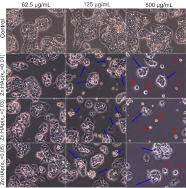 Figure 8. Inverted phase contrast microscopy of HepG2 cells cultivated in the presence of Zn:HAp  with x Zn  = 0.01, x Zn  = 0.03 and x Zn  = 0.05 at three different concentrations (62.5, 125 and 500 µg/mL)  compared to control