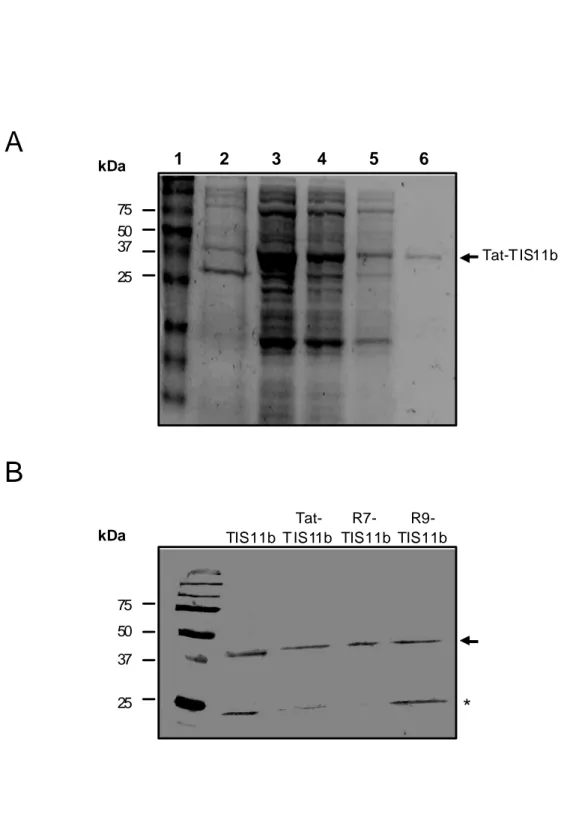 Figure 3ABTat-T IS11b1         2           3         4           56    kDa75375025kDa753750TIS11bTat-T IS11bR7-TIS11bR9-TIS11b25*