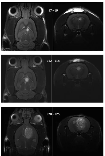 Figure  11:  Illustration  de  la  croissance  tumorale  suivie  en  IRM  dans  un  modèle  de  glioblastome  orthotopique  syngénique chez le rat