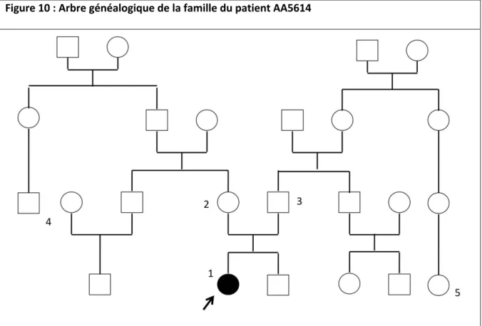 Figure 11 : Malformation capillaire - Patient AA5614 