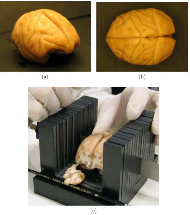 Fig. 1.6 – Vues d’un cerveau de macaque juste apr`es son extraction (a) et (b). D´ecoupage en blocs pour faciliter la fixation et la coupe (c).