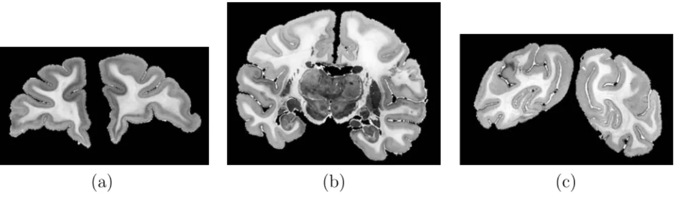 Fig. 1.8 – Coupes en incidence coronale de babouin dans la r´egion rostrale (a), centrale (b) et caudale (c)