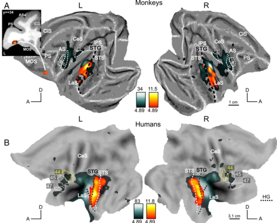 Figure 4: Processing of primate vocalizations. (A and B) In red, SPM T-maps for the contrast [(French + Hemo + Mvoc) - (SFrench + SHemo + SMvoc)] at p < 0.05 FWE corrected, masked inclusively with the positive effect of intact vocalizations ((French + H