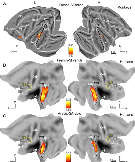 Figure 7: Scrambling effect for human speech. SPM T-maps (pb 0.05 FWE corrected) for the contrast French–SFrench in monkeys (A) and in humans (B)