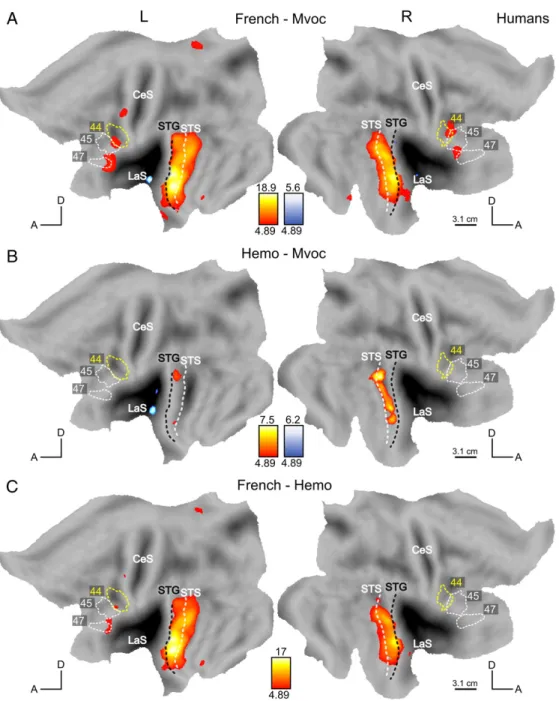 Figure 8: Comparison between sound categories in humans. SPM T-maps for the contrast French–Mvoc (A), Hemo–Mvoc (B) and French–Hemo (C) at p < 0.05 FWE-corrected, masked exclusively with effect of scrambling (p b 0.05 uncorrected) in a red (positive)–bl