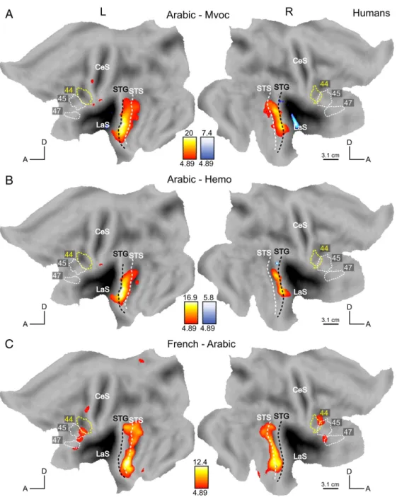 Figure 9: Processing of speech and intelligibility in humans. SPM T-map (p b 0.05 FWE corrected) for contrast Arabic–Mvoc (A), Arabic–Hemo (B) and French–Arabic (C) masked exclusively with effect of scrambling (p b 0.05 uncorrected) and shown in a red (pos