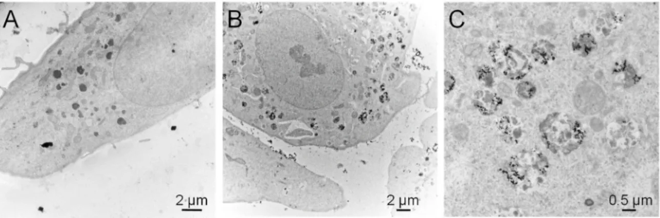 Figure 5. Transmission electron microscopic observation of A549 cells exposed to TiO 2 -NPs