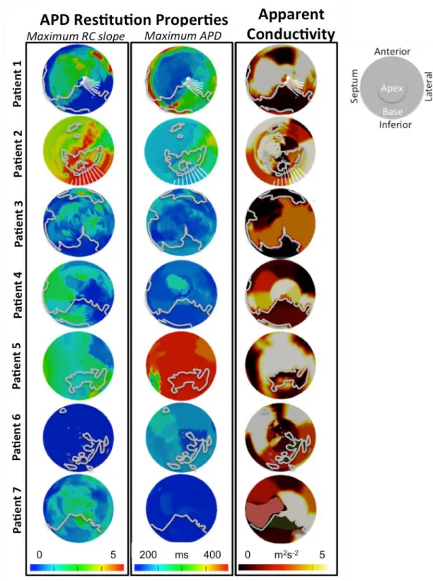 Figure 2. LV polar plot representation of the spatial distribution of the maximum slope  for APD-RCs, maximum asymptotic APD and AC