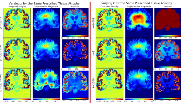 Figure 7: The prescribed atrophy is a uniform atrophy only in the cortex. Left: Effect of varying µ with k = 1 kPa −1 and λ = 0 kPa