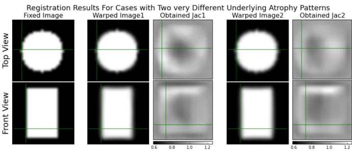 Figure 11: Registration results when using the input image of Figure 10 as a fixed image (first column) and the two simulated images of that figure as moving images (not shown here)