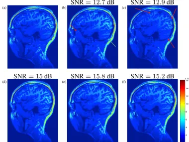 Fig. 3. Reconstruction results for R = 4 (slice 42): (a): Reference image. (b): pMRI line undersampling