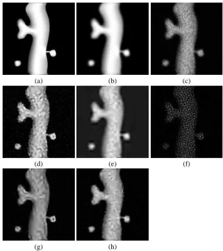 Fig. 1. Deconvolution of a simulated neuron (Intensity 6 30). (a) Original, (b) Blurred, (c) Blurred&amp;noisy, (d) RL-TV, (e) NaiveGauss, (f) AnsGauss, (g) RL-MRS, (h) Our Algorithm.