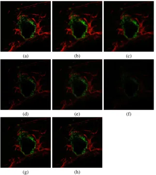 Fig. 3. Mean ℓ 1 -error of all algorithms as a function of the intensity level for the deconvolution of the cell