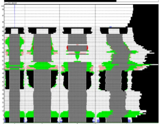 Fig.  10.SIMMER  calculation  of  the  TIB  scenario  with enriched fuel pins 