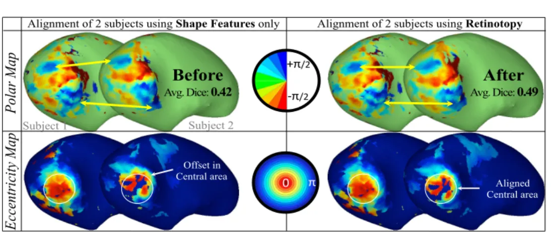 Fig. 8. Alignment of Retinotopy with Brain Transfer – (Top) Polar and (Bottom) Eccentricity map, before and after use of functional features