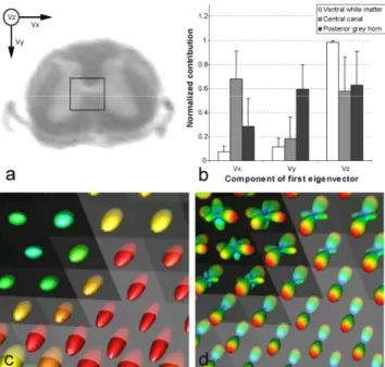 Tab. 1. GFA quantification in the white and grey matter at  various b-values (given in s/mm 2 )