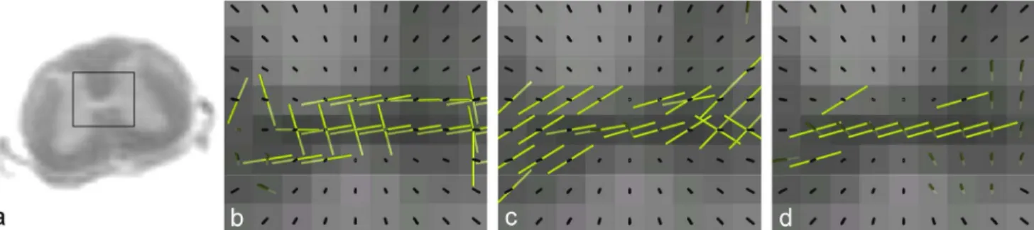 Fig. 3. Impact of b-value on fODF estimation. Comparison of fODF maxima in a region centred over the central canal (a) for b- b-values of 1000 (b), 2000 (c) and 3000 s/mm 2  (d)