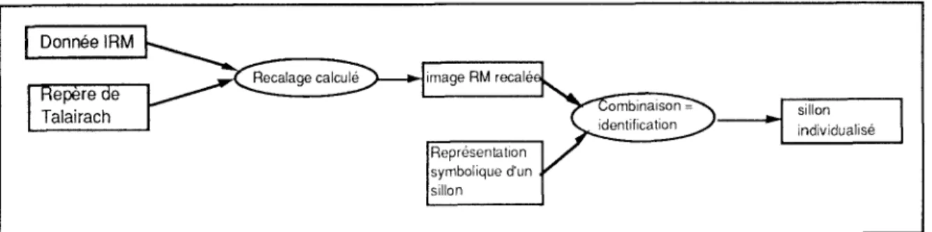 Figure 7 . — Identification d'un sillon : fusion de données IRM et modèle de sillo n