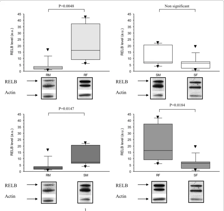 Figure 6 Western blot analysis of RelB in CLL patients. The expression of RelB is higher in resistant CLLs in females (RF) (n = 6, 21.2 ± 15.5) than in resistant CLL in males (RM) (4.2 ± 4.8, n = 10), U test p = 0.0048; higher also in resistant females (RF