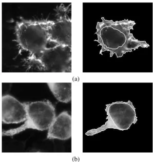 Figure 3: An Mb (a) and an ER (b) extracted cells and their two segmented regions of interest.