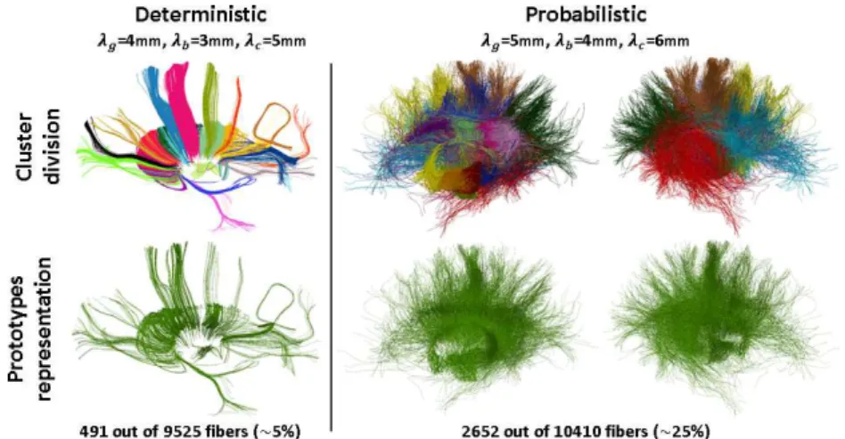 Fig. 2. First row: clusters of the right thalamo-cortico bundle highlighted in different colors