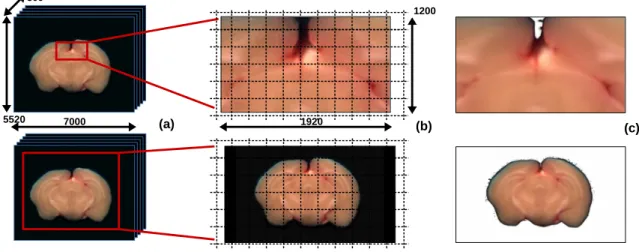 Fig. 3. Results: Mouse brain block-face volume (~86 GB) render in ~30 ms. (a) A full large-scale slide inside an images stack