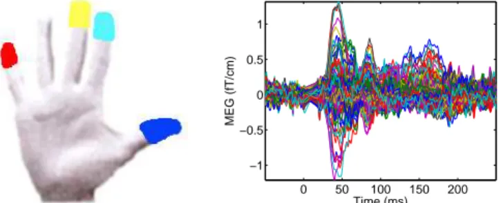 Figure 7. Labeling results of the left primary somatosensory (S1) cortex in MEG using both ℓ w ;2 and ℓ w ;212 priors