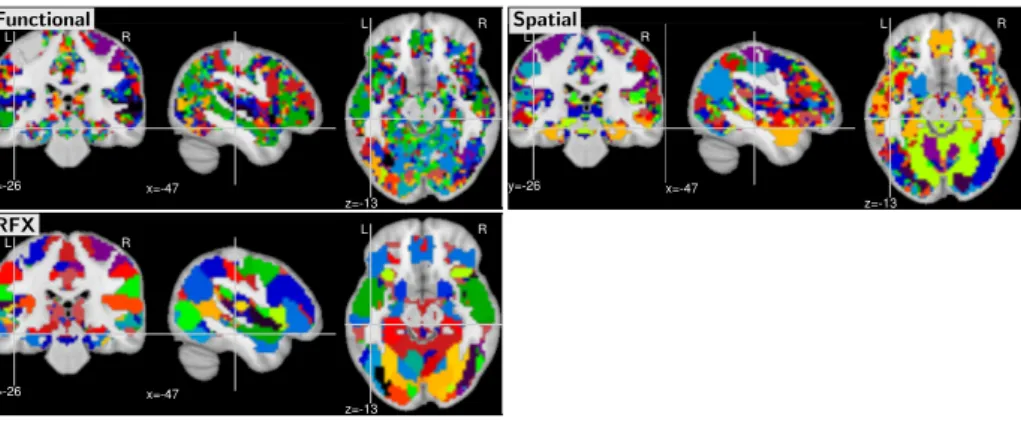 Fig. 4. Parcellations for the different strategies. The colors are random.