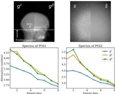 Fig. 5. Left: Picture of the CIRS phantom; right: picture of the RANDO phantom.