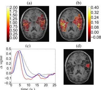 Fig. 4. Results on real fASL data for a subject of the AINSI database, for the auditory condition (radiological convention: Left is right)