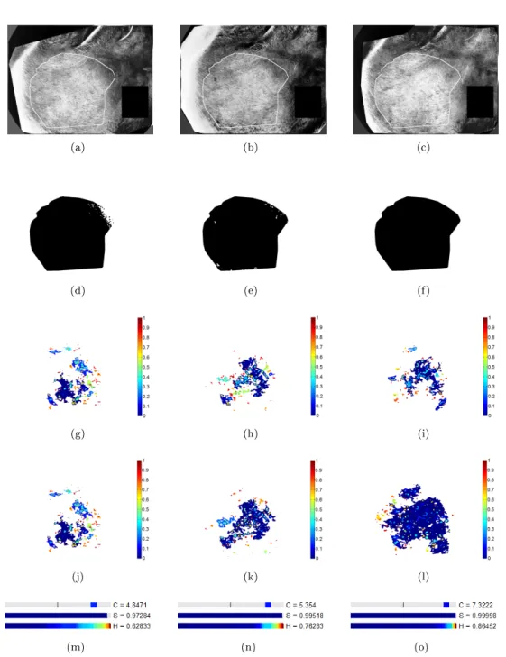 Figure 9: Changes map and graphical representation of the dierential score for a patient whose pathology decreases during the treatment period