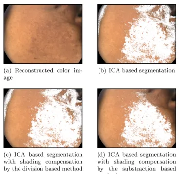 Figure 5: Classication results with the ICA based method depending on the shading compen- compen-sation method
