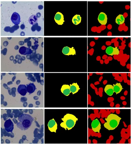 Figure  9.  Segmentation  samples.  First  column  demonstrate  the  original  images,  second  are  segmentation results, and third are ground truth images