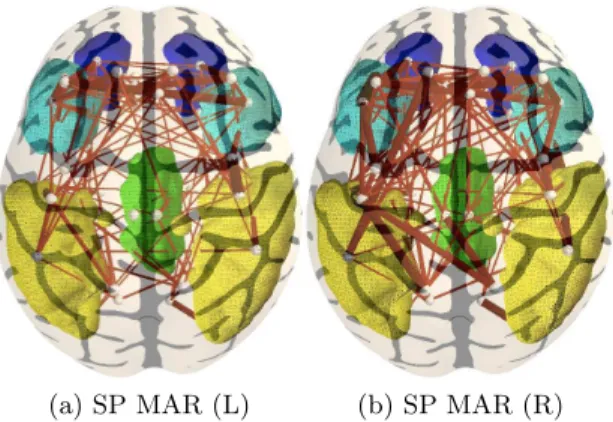Fig. 5: Identifying structural connections associated with the default mode net- net-work