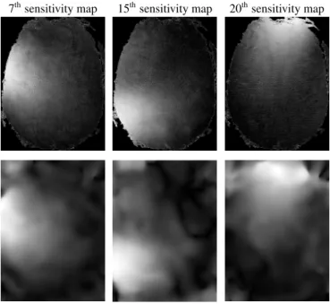 Table 1. Ex-vivo baboon and in-vivo Human brain data collected using various slice thickness and acceleration factor R.