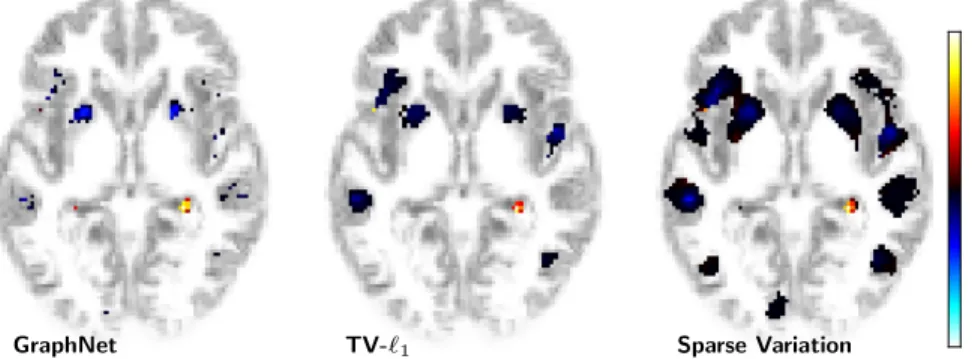 Fig. 4. Weight vectors for age prediction from VBM maps from the Oasis dataset.