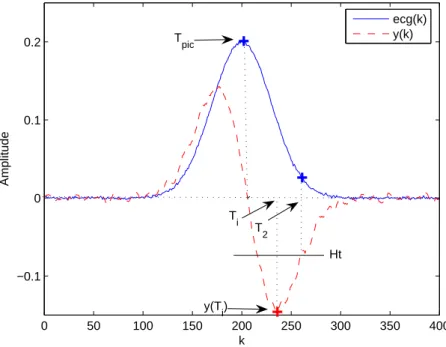 Figure 4.3  Détection de la n ( T 2 ) et du pic ( T pic ) d'une onde T normale avec la méthode de Laguna et al