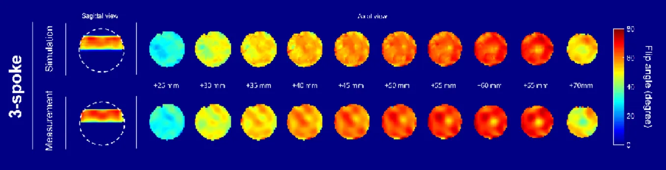 Figure 3: Flip angle Bloch simulations for 3-spoke excitations following c1 and c2 designs, and for the standard  circularly  polarized  (CP)  mode  (TBW=10)