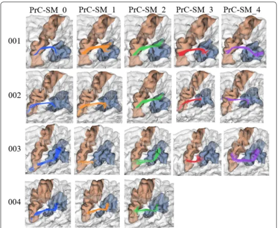 Fig. 2  Correspondence of intra‑subject bundle labels across subjects. Comparison of the first five bundles  from four subjects (001–004), connecting PrC and SM gyri