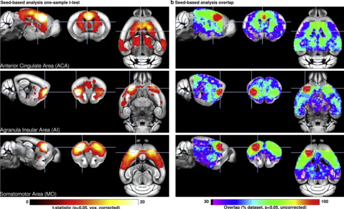 Fig. 3. Seed-based analyses (SBA) for 3 selected seeds positioned in the left hemisphere