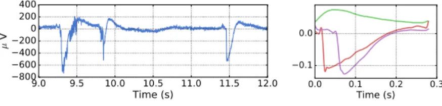 Figure 4: Atoms learnt by αCSC on LFP data containing epileptiform spikes with α = 2.